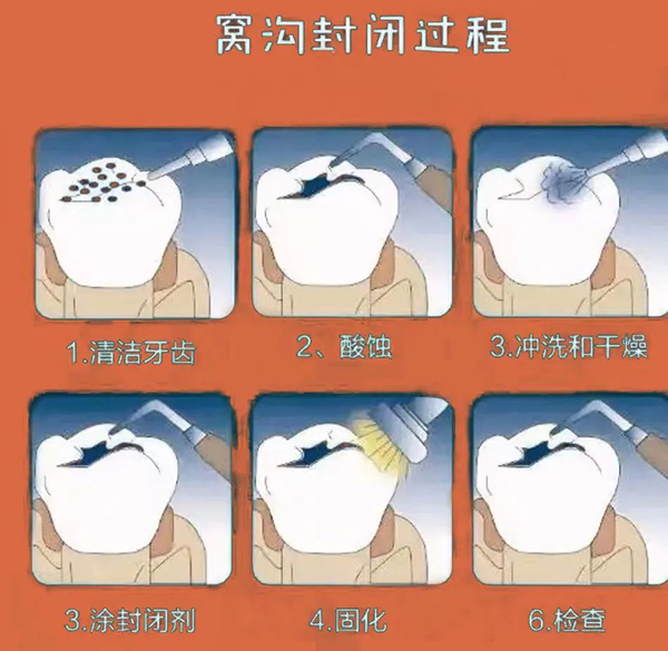 6.jpg 6.jpg